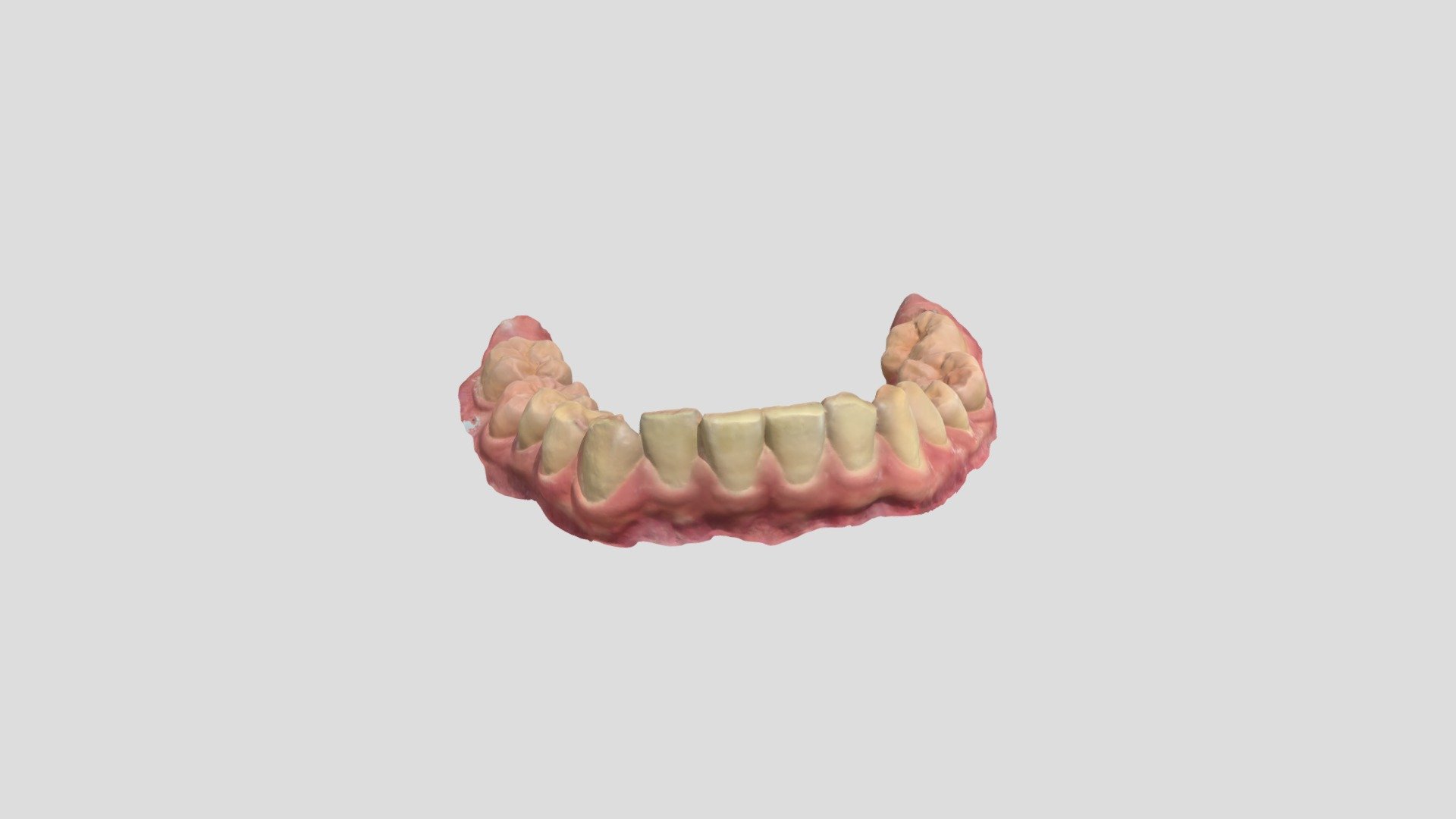73376264_shell_teethup_l