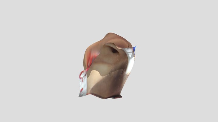 Third_ventricle_floor 3D Model