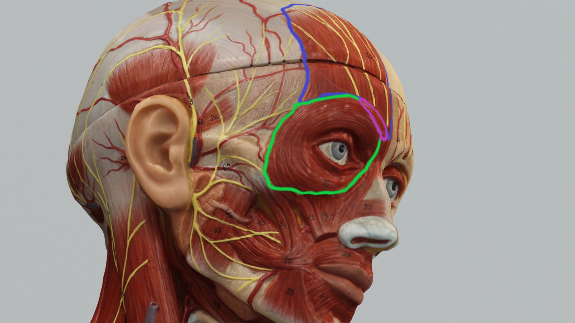 3D model Model Temporal Branch of Facial Nerve