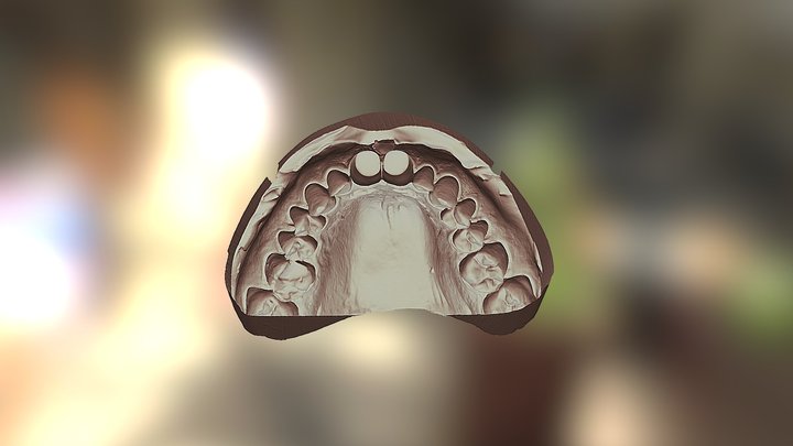Зубы 21 22 - челюсть 3D Model