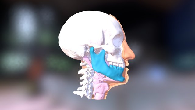 IMDO BiMax (After) 3D Model