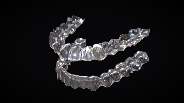 Teeth aligner / Invisible Braces 3D Model