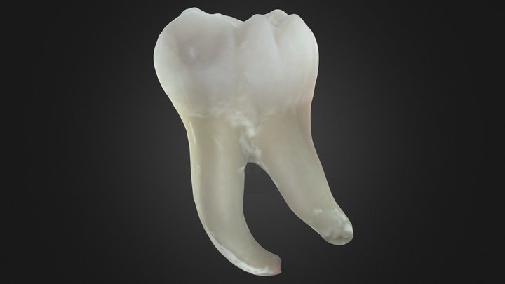 Dente 36 - Lower Left First Molar (ID 36d) 3D Model