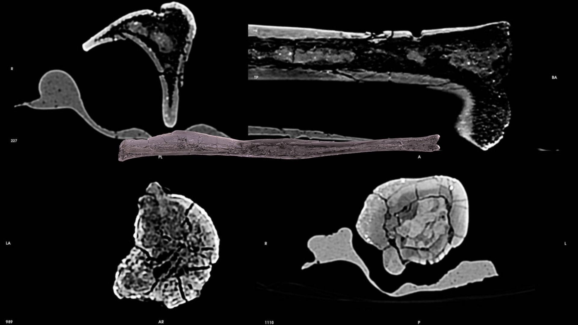 Seeing inside the bone