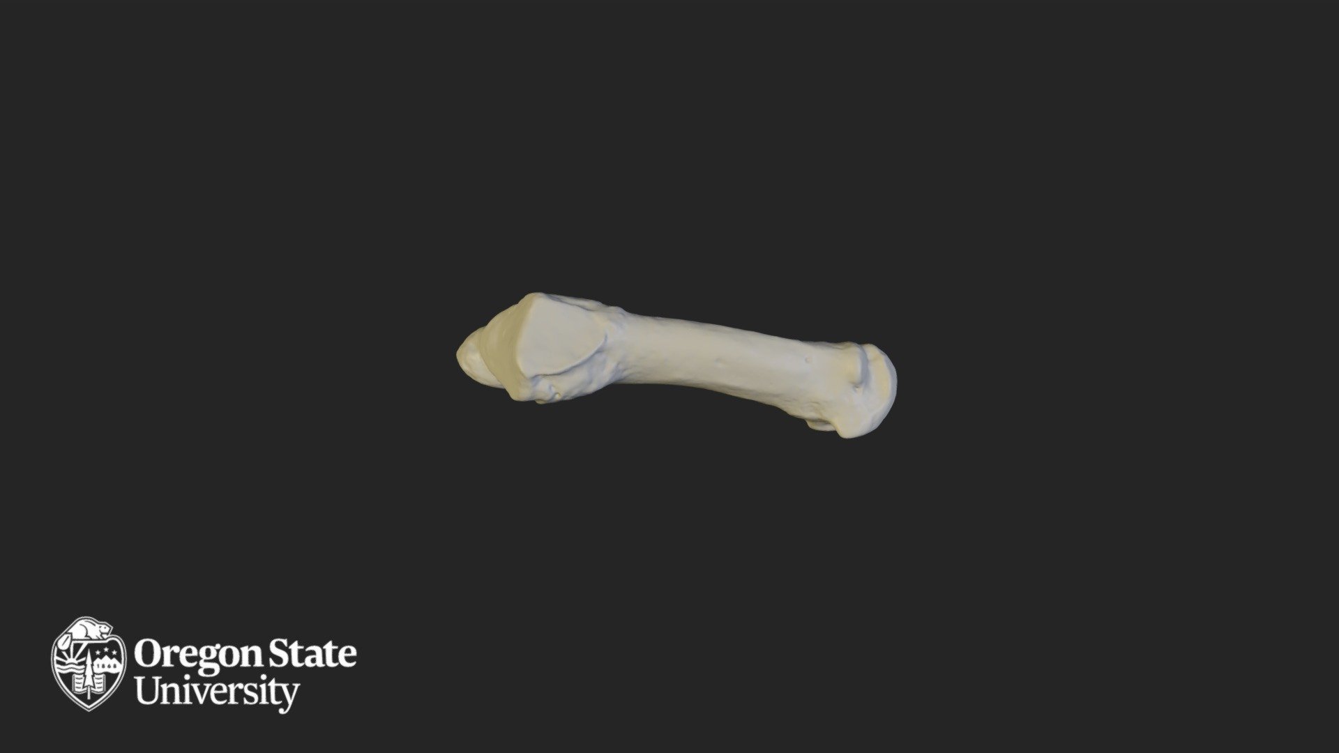 Metatarsal 5
