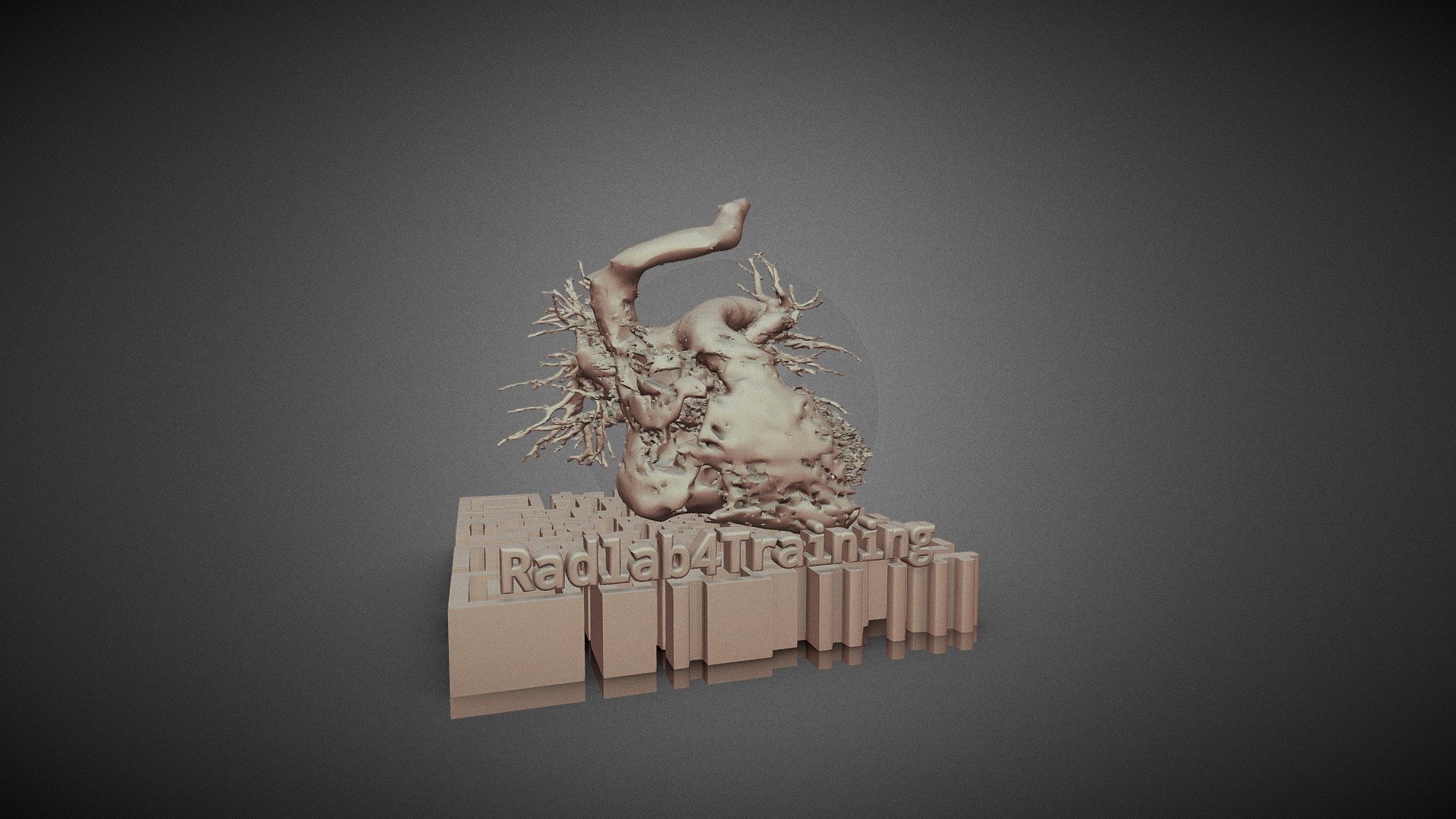 Pulmonary Circle Biomodel — Sketchfab embed 3D viewer
