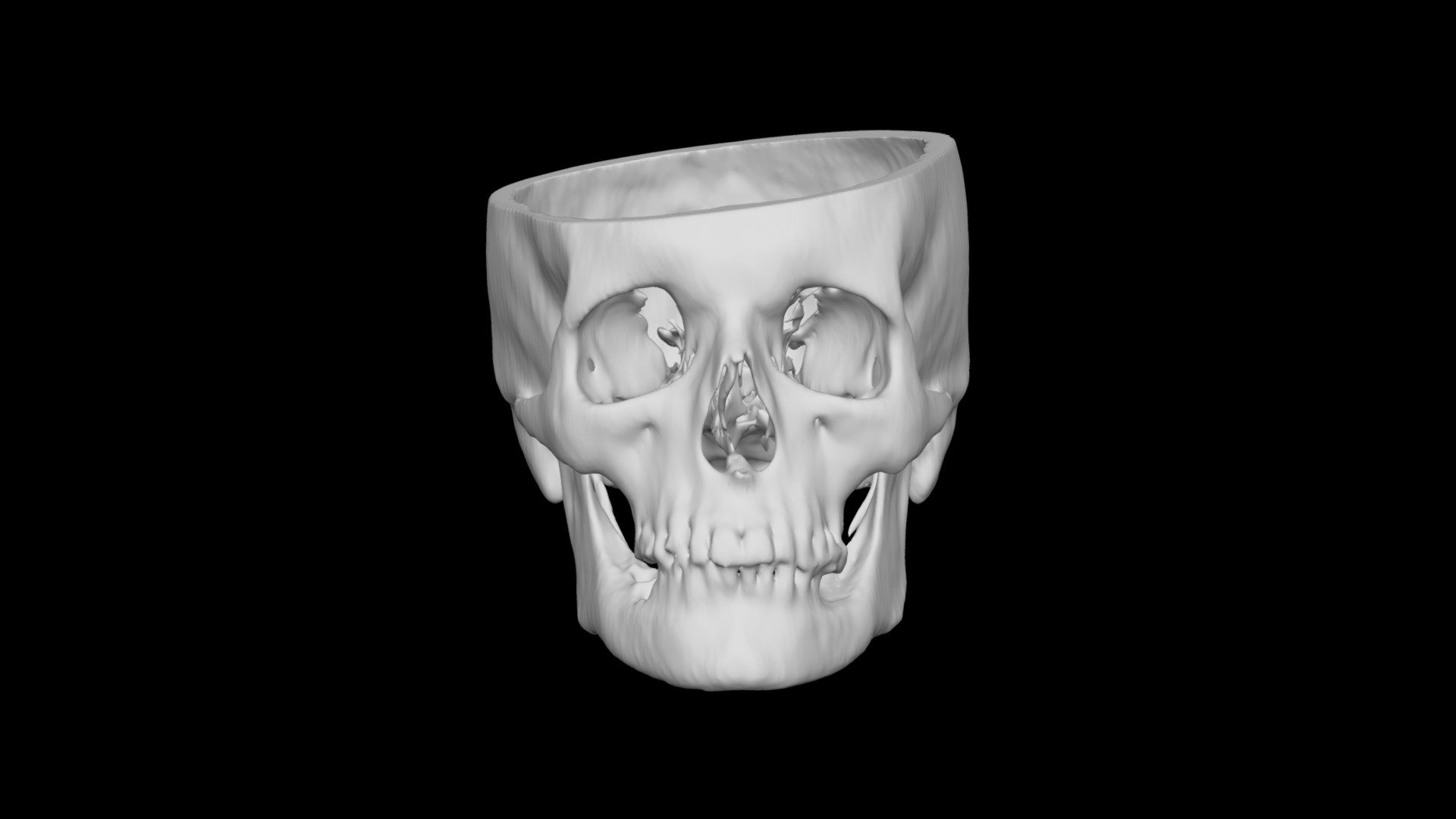 Skull Male 68yo