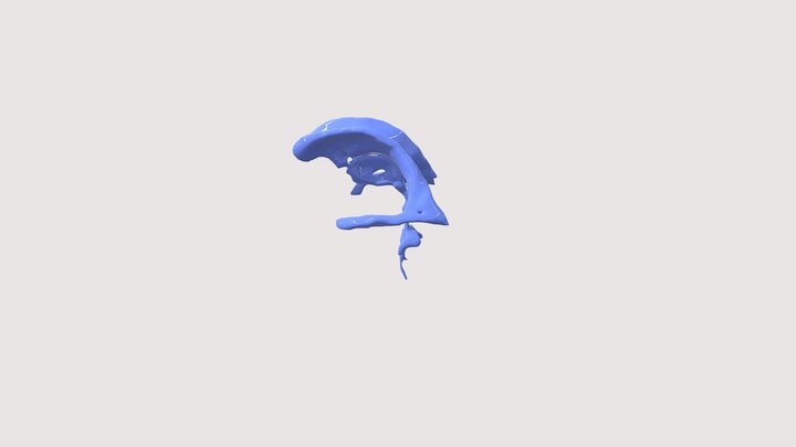 Ventricles of the Brain 3D Model