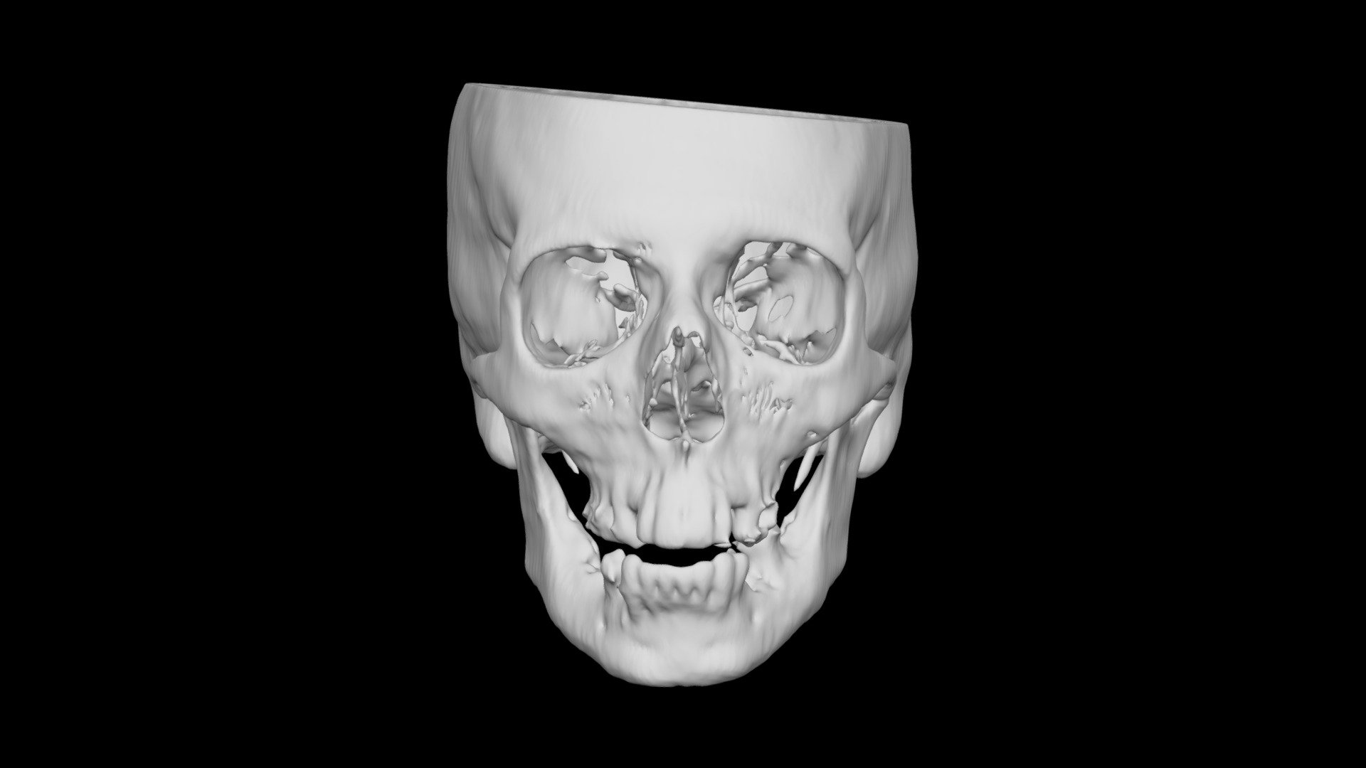 Skull Female 60yo