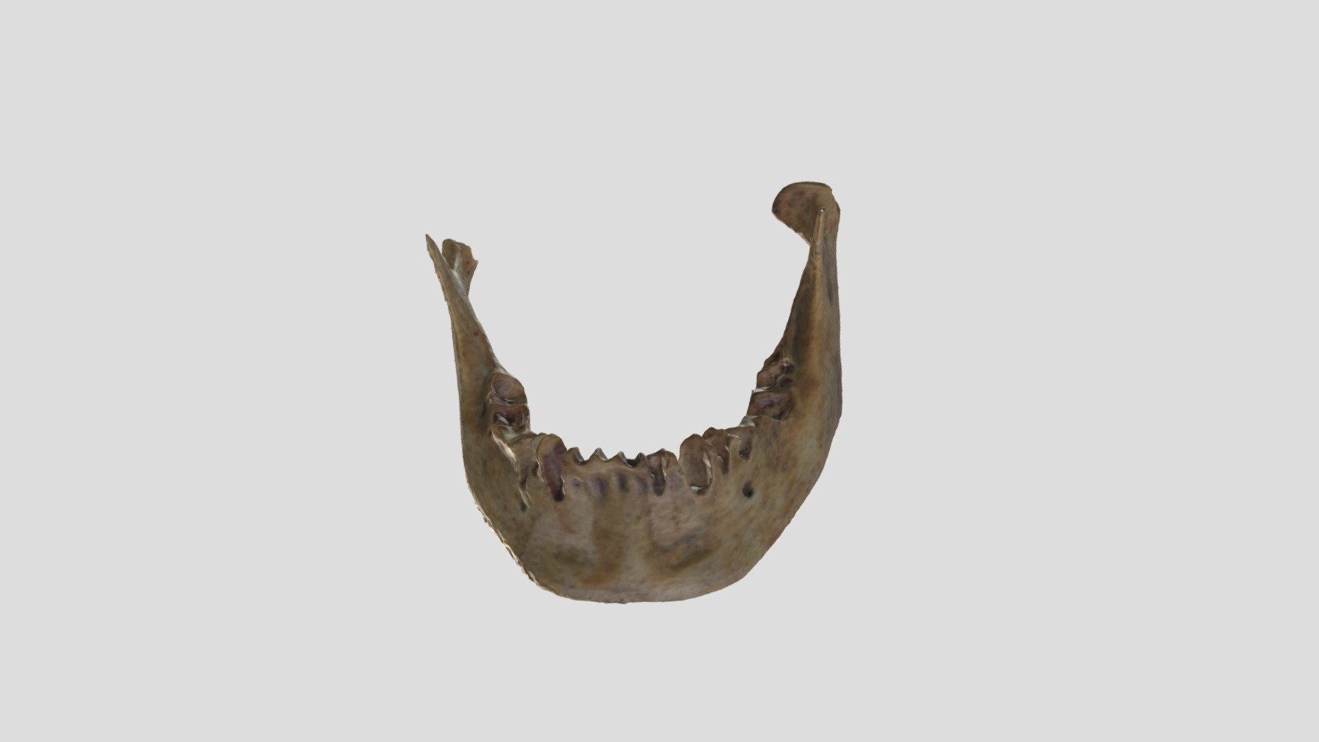 Mandíbula_1