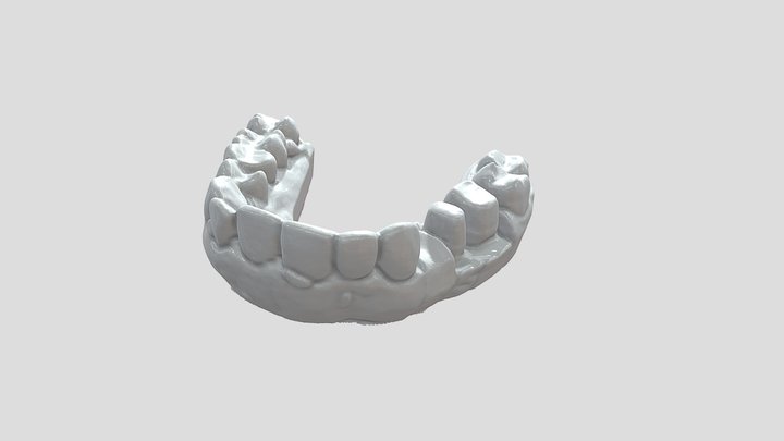 Dentures by Seal lite