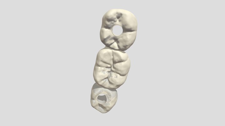 bridge sur implants 3D Model