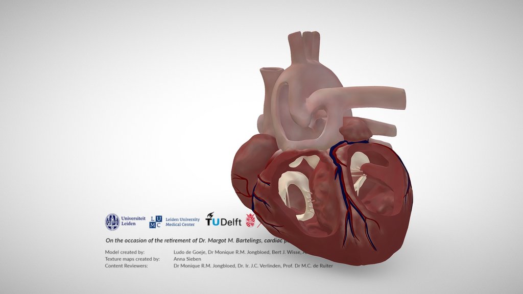 Human Anatomy - Pathologies - A 3D model collection by ...