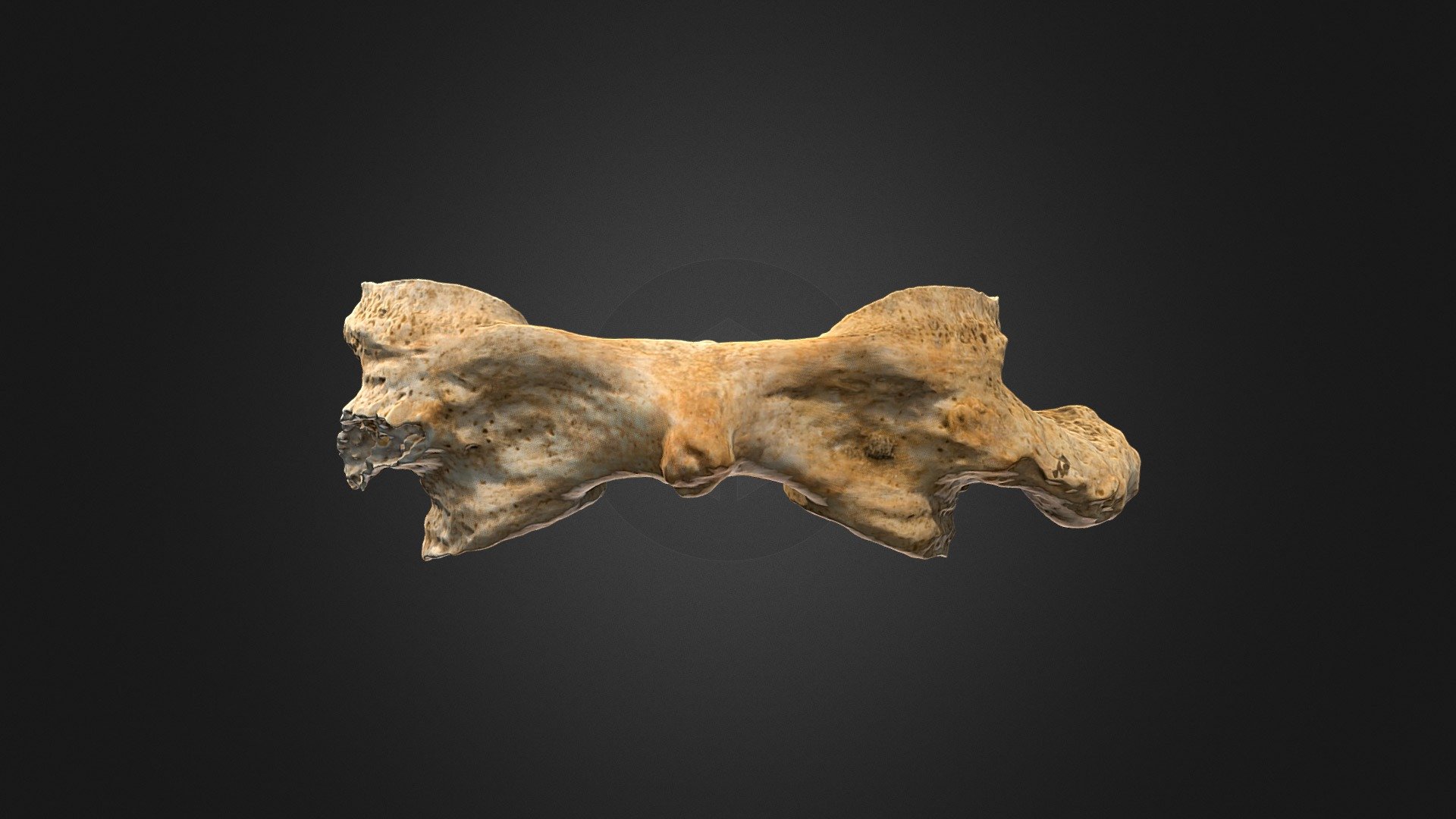 vertebra 4 C1