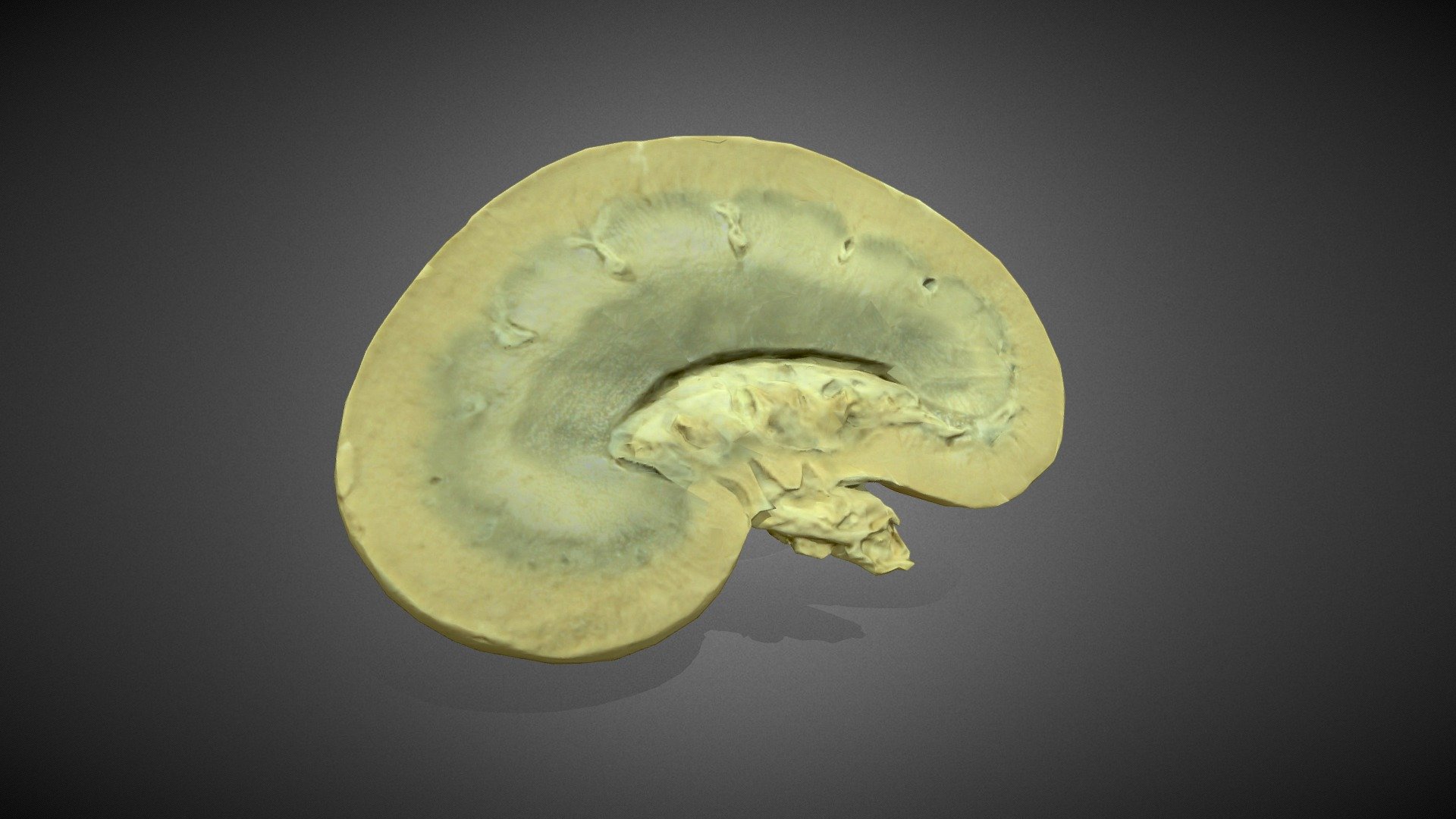 Kidney Test