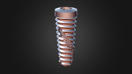 Implant DNA File1 700microns 3D Model