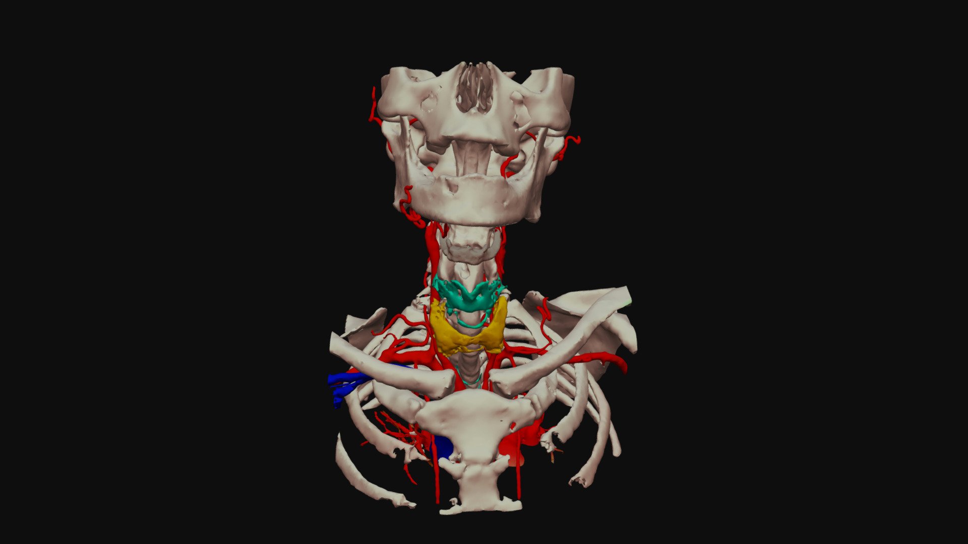 Vascular head from angio-CT