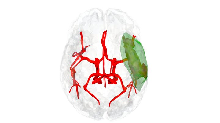 Left_M1_Occlusion_Copy 3D Model