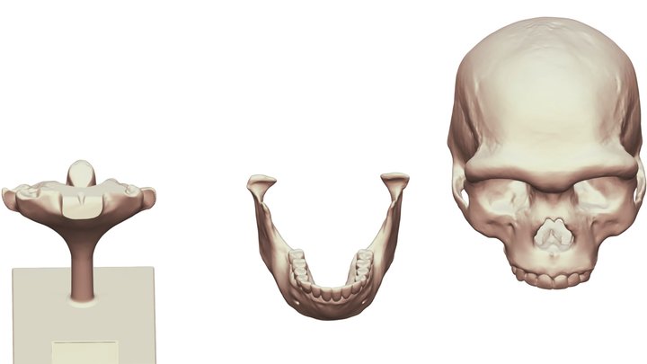 Harbin Cranium Reconstruction Stand Jaw 3D Model