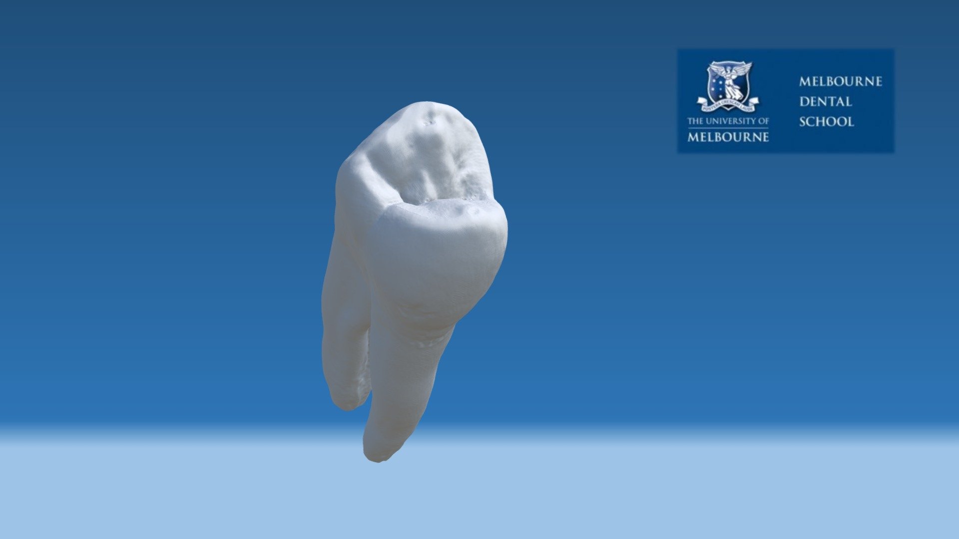 Maxillary Premolar - 3D Model By Melbourne Dental School ...