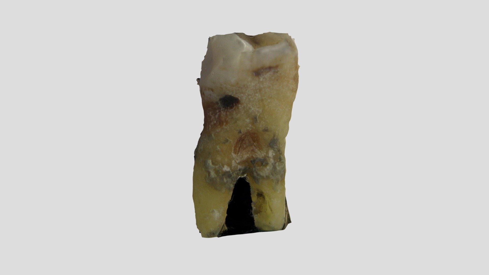 Premolar 3