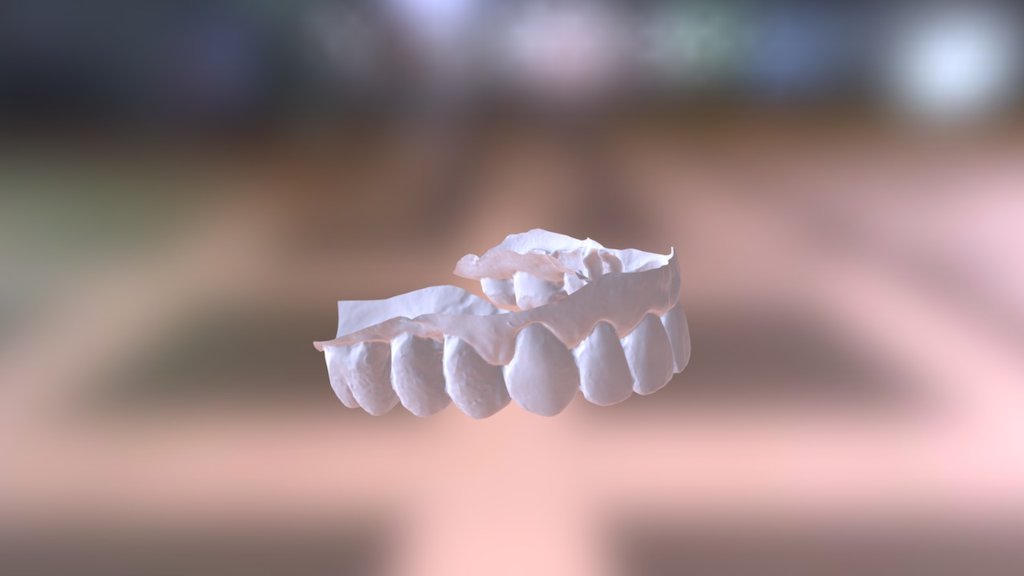 Felicity Upper Jaw