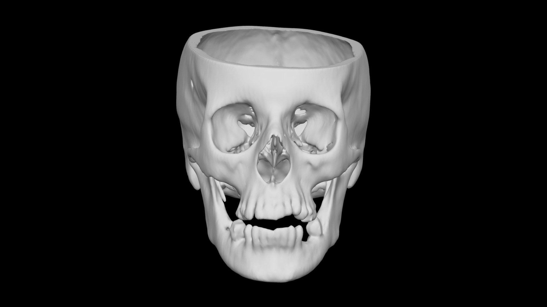 Skull Female 68yo