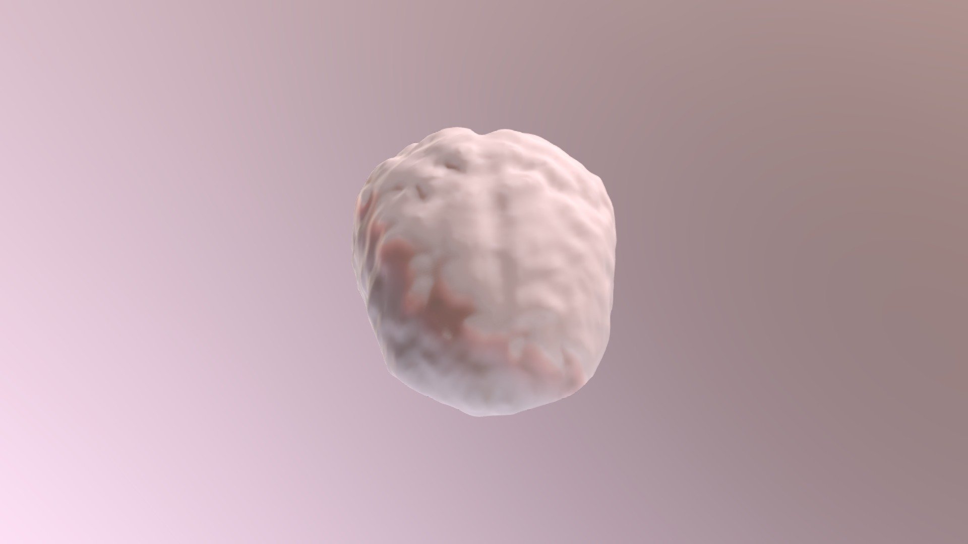Tumor Project I&M - Download Free 3D model by Iris Indig (@IrisIndig ...