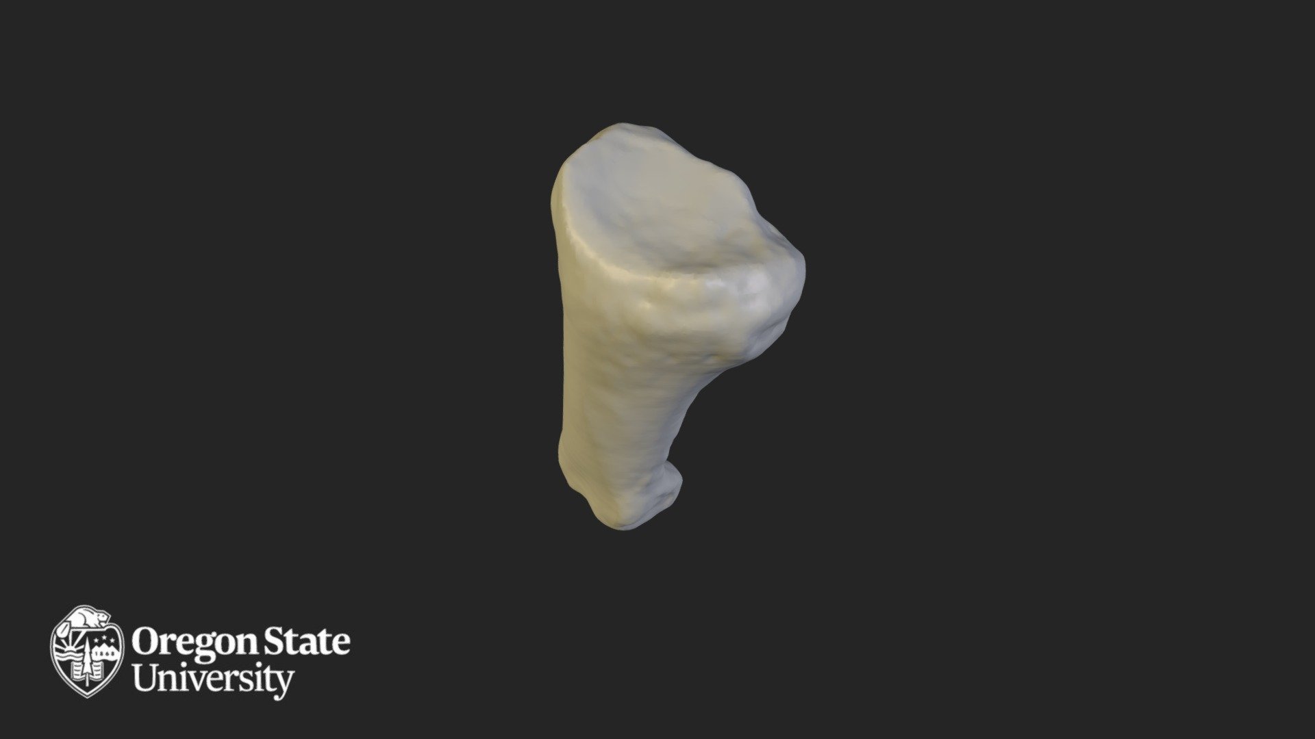 Proximal Phalange 5