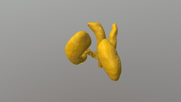Segmented Kidney Model 3D Model