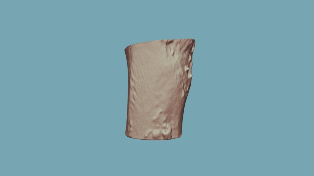10-3 (Post-burn)