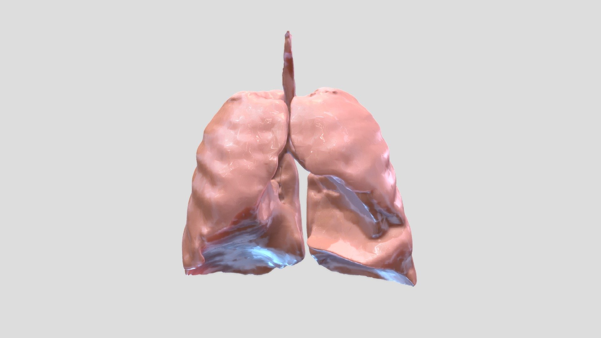 Lung Carcinoma - Download Free 3D model by Brandon Holt (@BrandonHolt ...