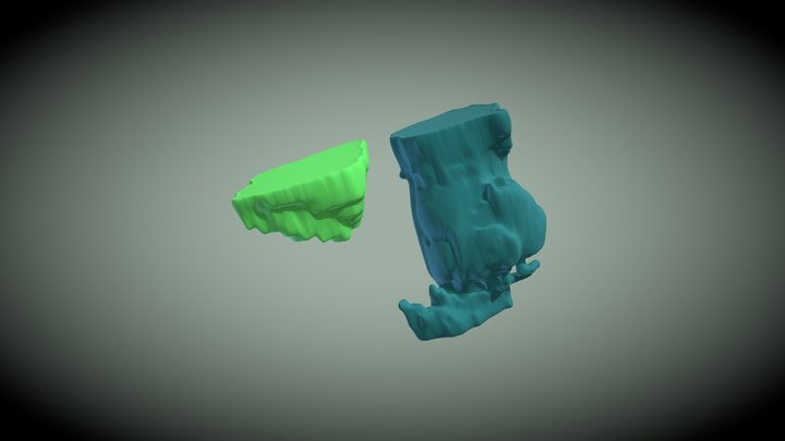 Bladder and Rectum Segmentations - Gilmore 3D Model