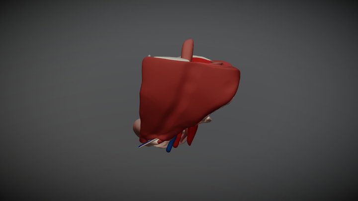 hernia coloured 3D Model