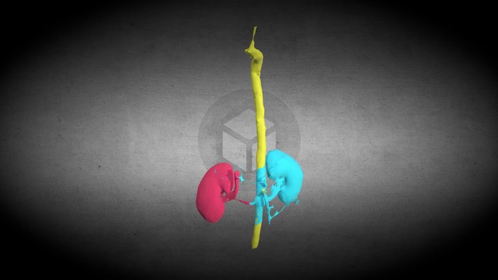CTA cardio segmentation 3D Model