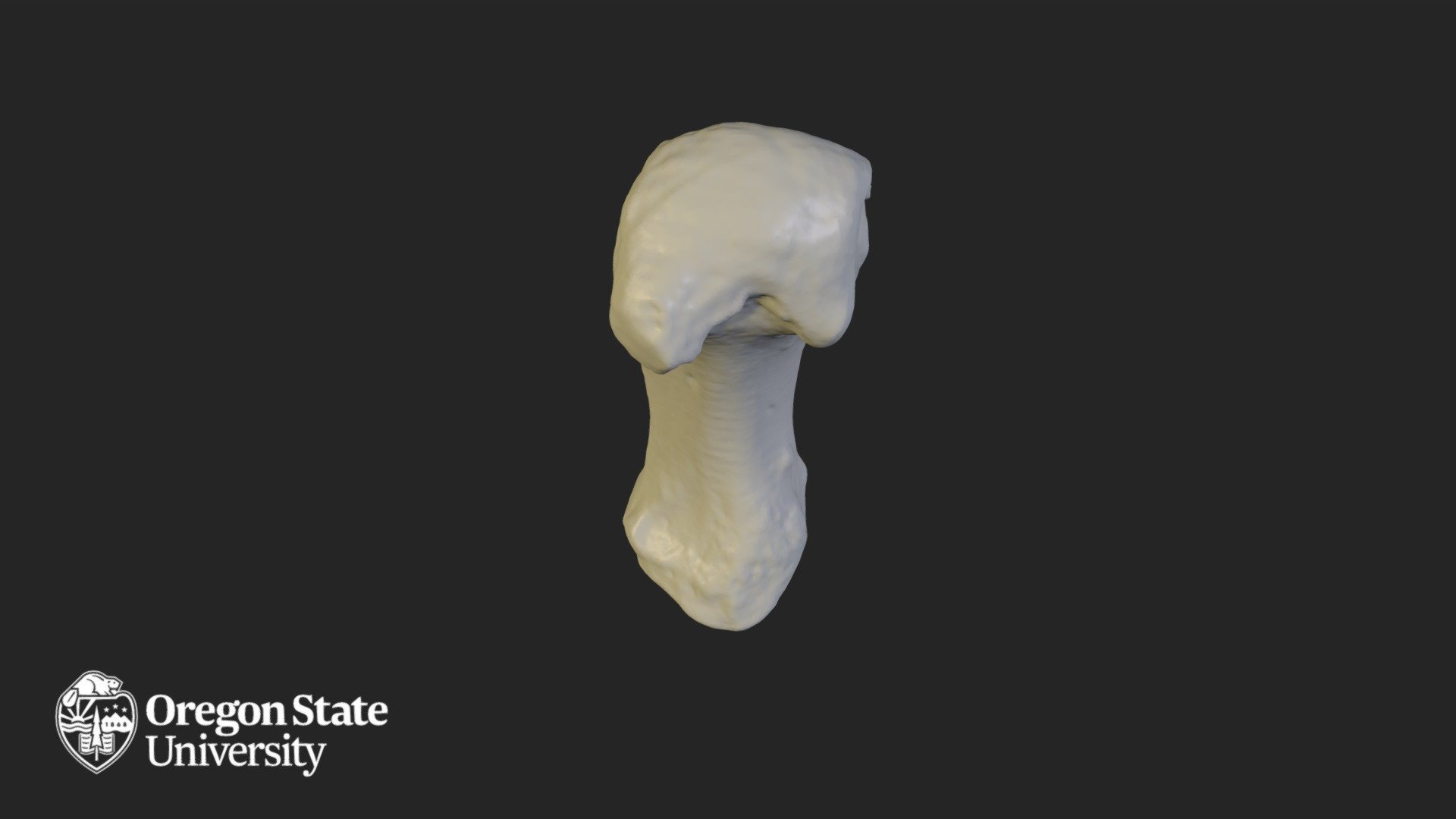 Metacarpal 1