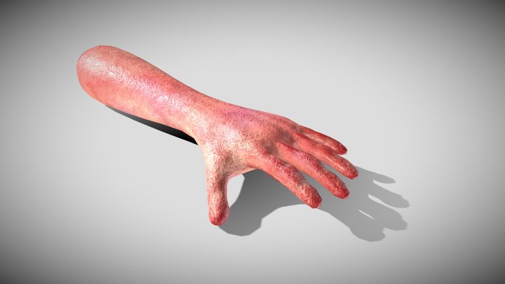 Severed Arm – Modello 3D gratuito STL