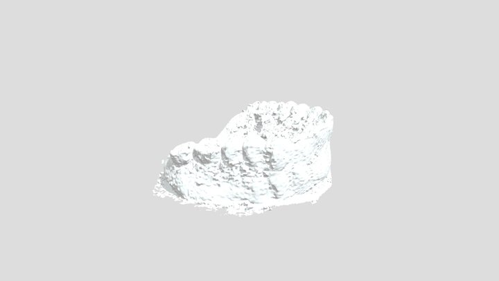 Dentures 3D Model