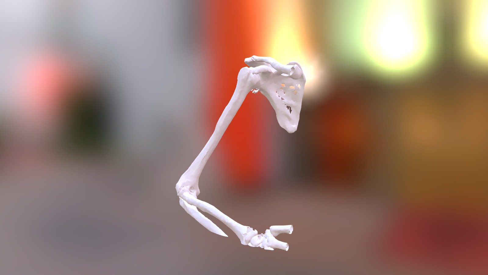 Shoulder Arthritis - sku381 - 3D model by orto3d [897f7e7] - Sketchfab