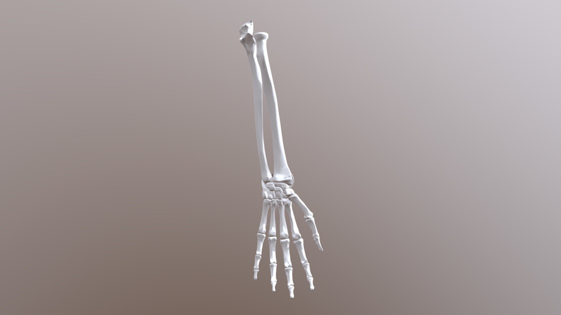 Wrist- Condyloid Joint