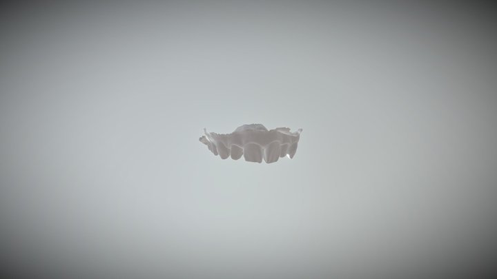 Full Arch 2-upperjaw 3D Model