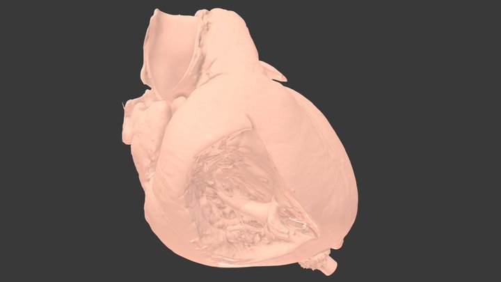 Normal #10 - Normal heart {S,D,S} 3D Model