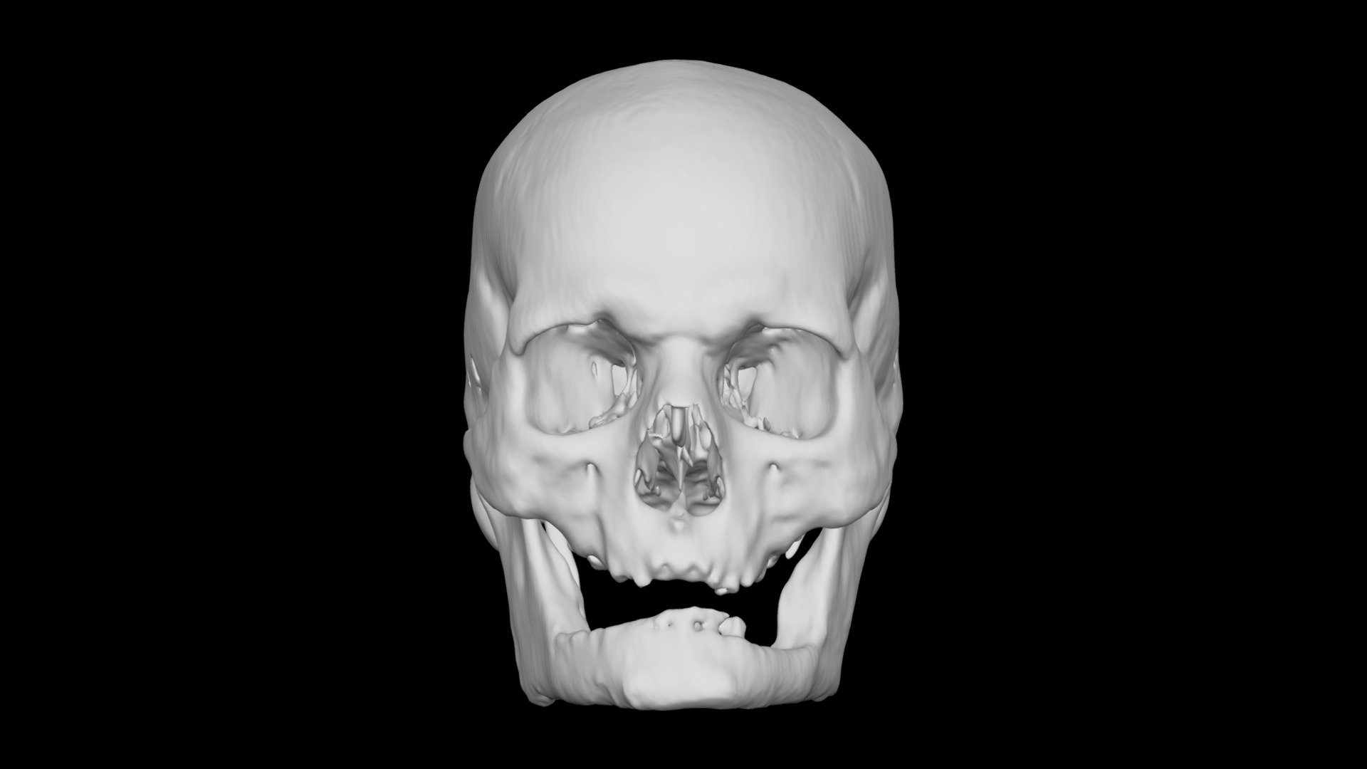 Skull Male 69yo