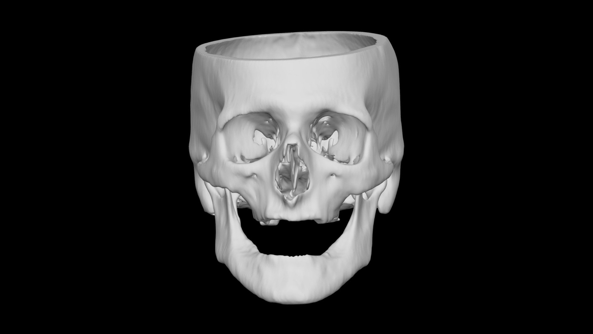 Skull Male 59yo