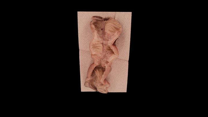 Bowel 1a 3D Model