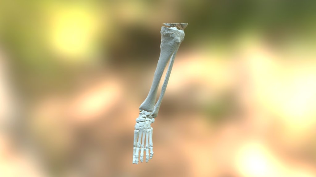 Vghtpeortho Before