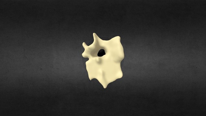 Segmentation_ Vertebra 3D Model