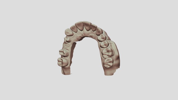 4 UpperJawScan 3D Model