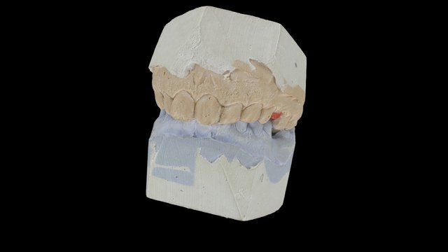 3d scan denture 3D Model