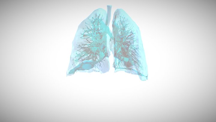 Lungs from Slicer 3D Model